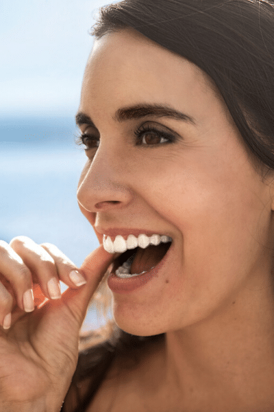 Insvisalign is a discreet way of wearing braces
