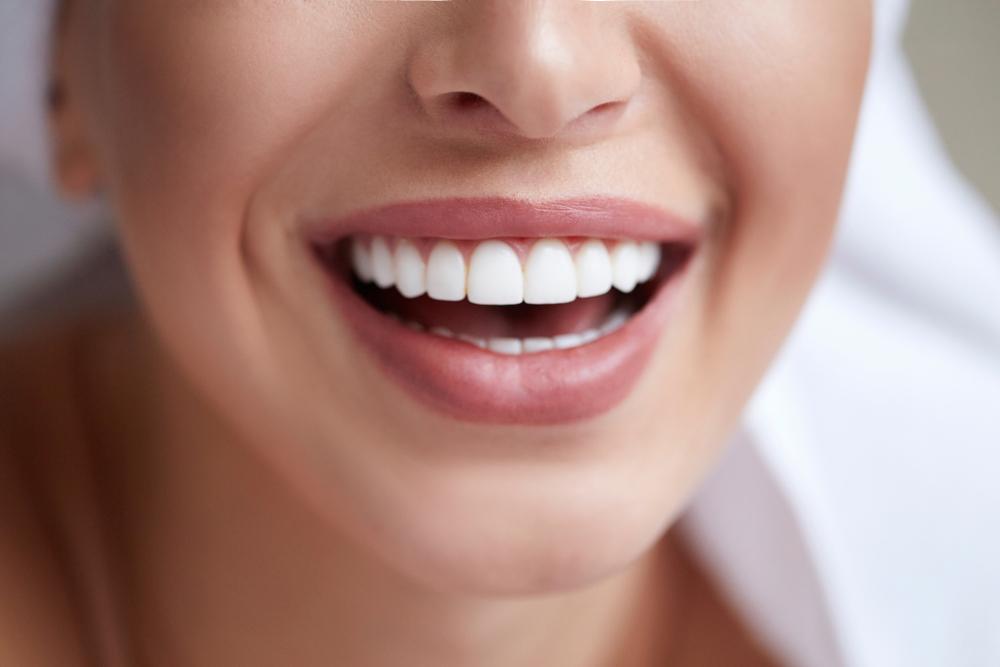How to care for your veneers